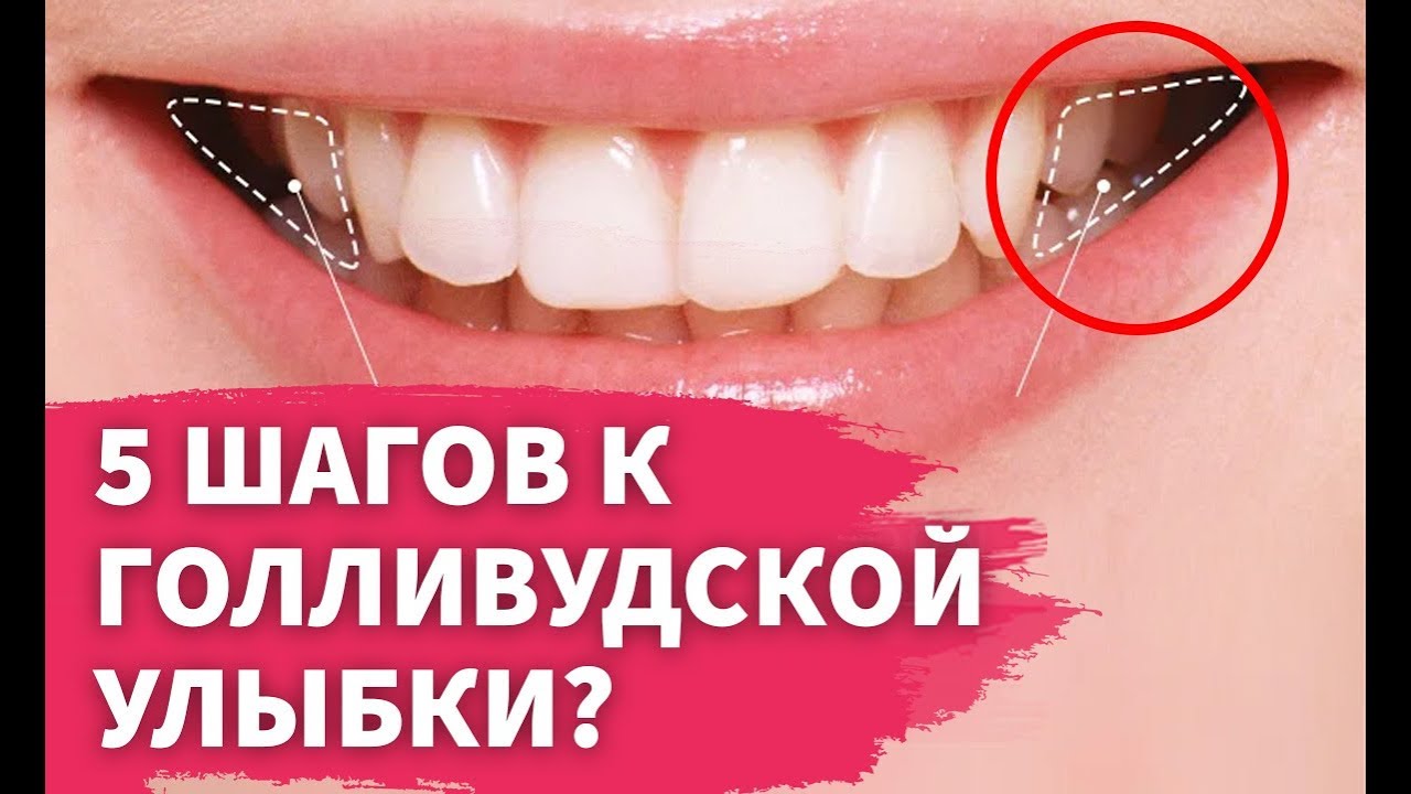 Как иметь идеальную улыбку: 14 шагов (с иллюстрациями)