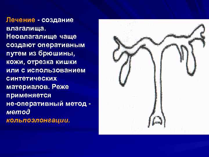 Как стать мамой при синдроме рокитанского-кюстнера-майера-хаузера