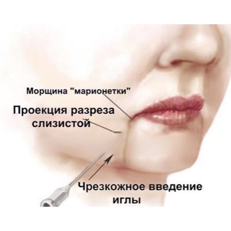 «зачем увеличивать точку g?»: откровенный разговор с известным гинекологом - portofranko