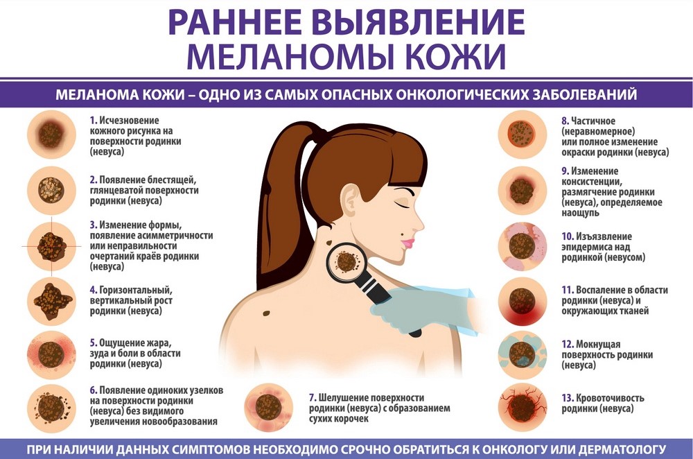 Может ли психика повлиять на возникновение рака и что скрывается за страхом онкологии:  поговорили с онкопсихологом в петрозаводске