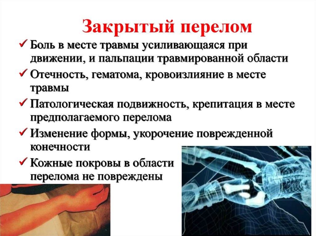 Можно ли сломать половой член во время аварии или полового акта?