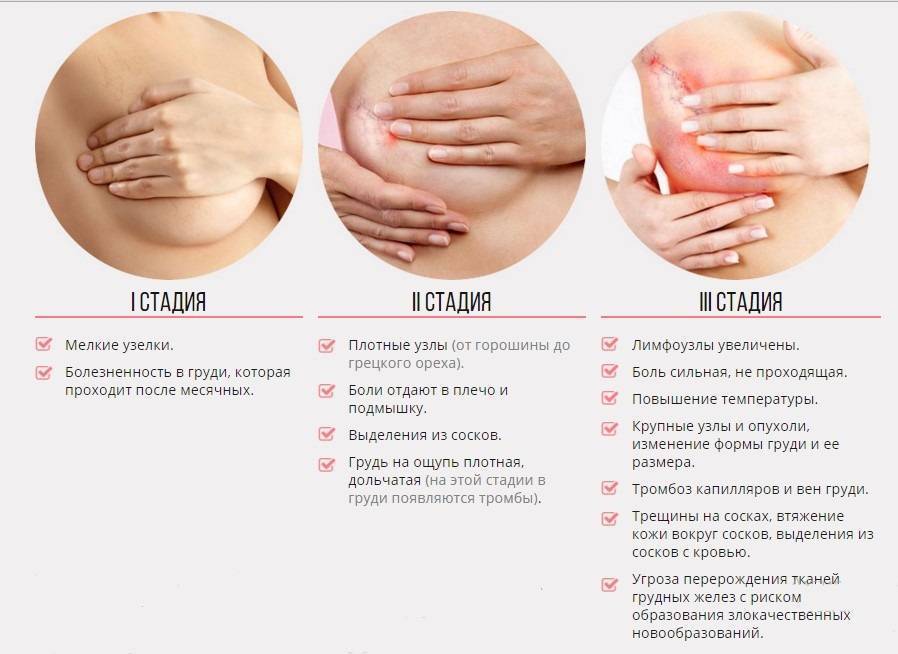 Знаменитости, которые поддерживают движение «освободи соски»