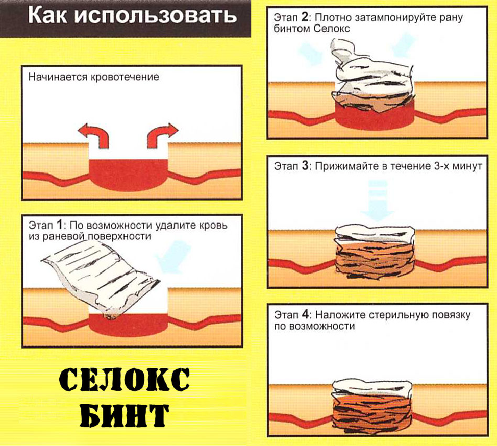 Как остановить обильные месячные, как остановить обильное кровотечение при месячных