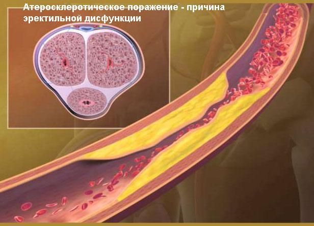 Что делать, если у мужчины большой член - 69 секретов