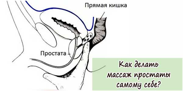 Массаж простаты - методики и техники массажа простаты