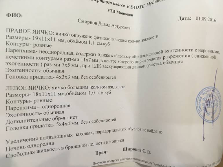 Яички у мужчин - строение, функции, заболевания