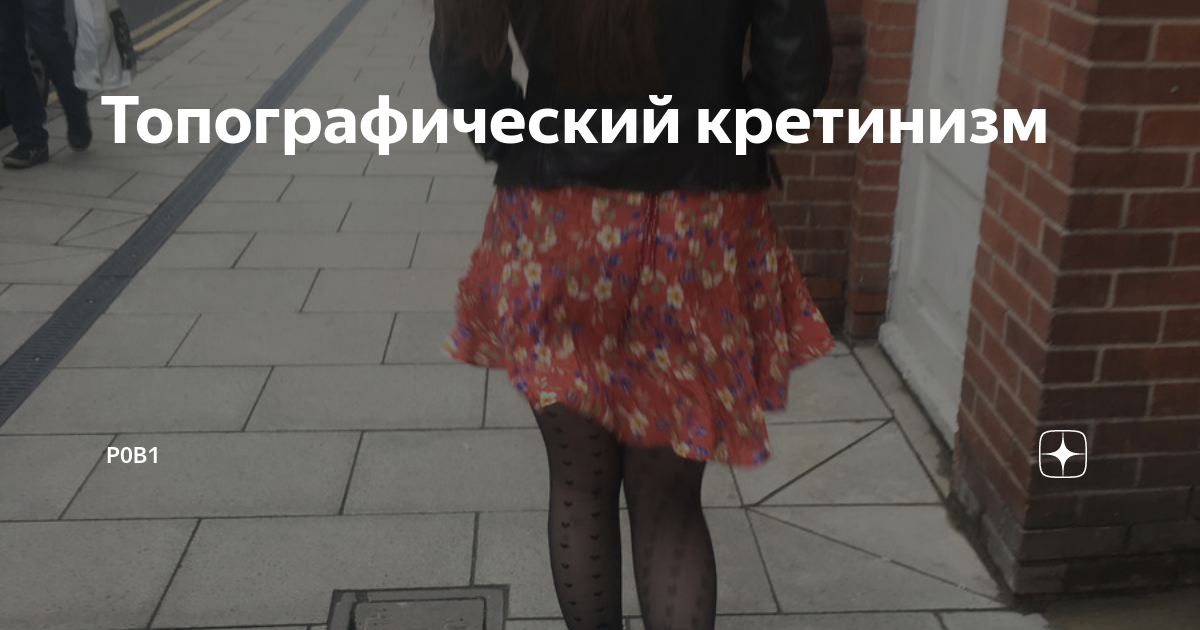Топографический кретинизм: что это такое, симптомы, причины, лечение