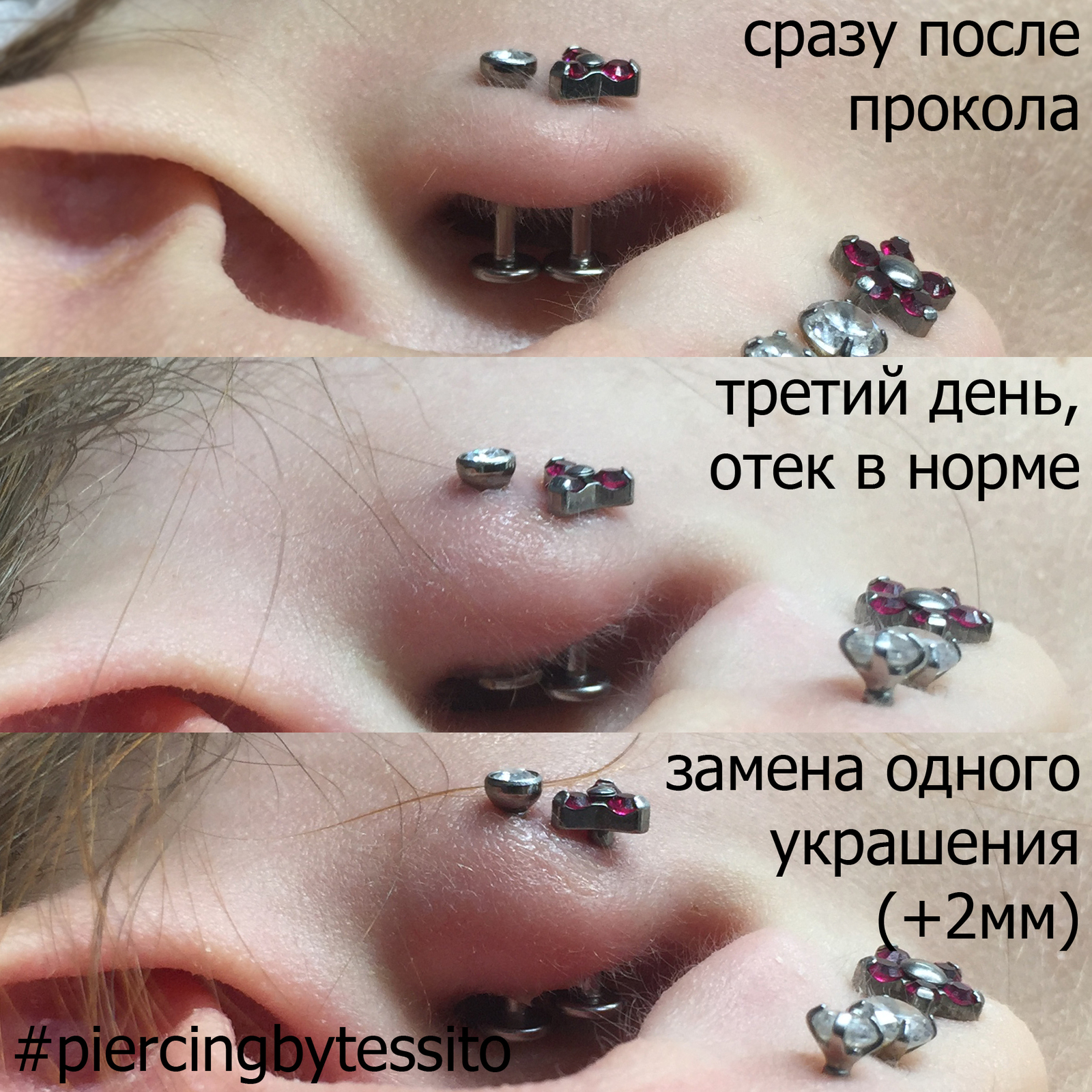 Пирсинг с точки зрения врача