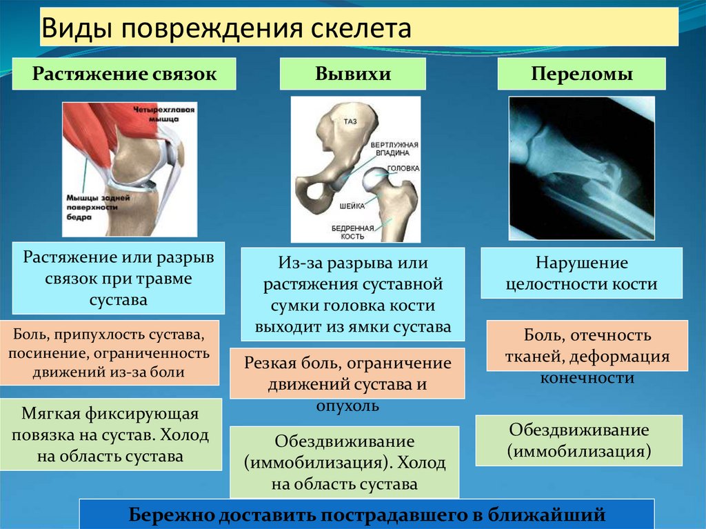 Что нужно знать про перелом члена: что делать если сломал член 🚑