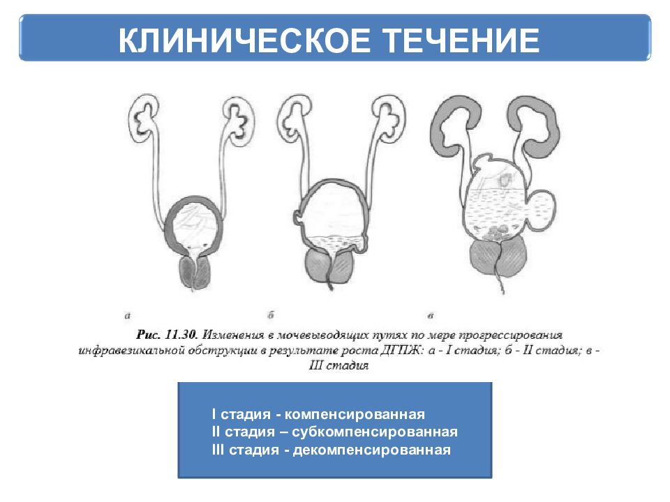 Массаж предстательной железы - описание услуги, при каких болезнях и какие врачи назначают