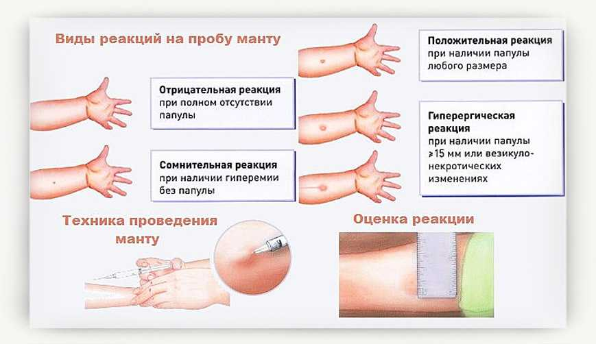 Хочу ли я ребенка: как понять и принять важное решение