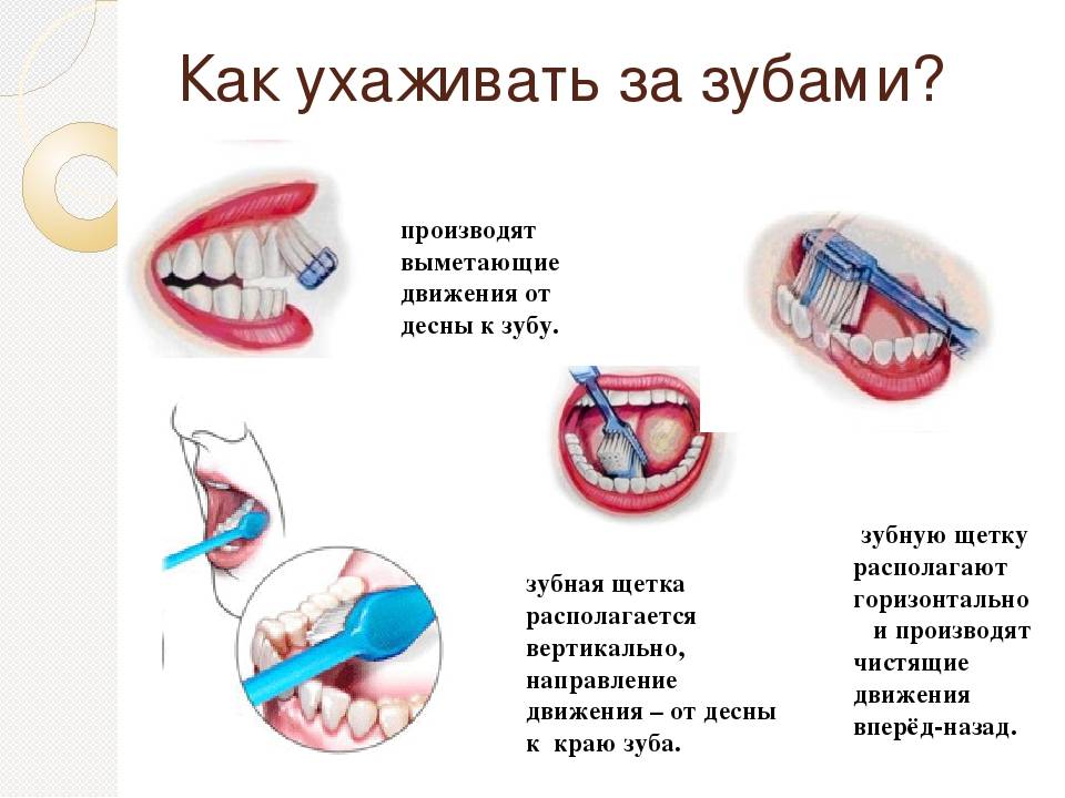 Лучший способ чистки зубов - выбираем из возможных вариантов!