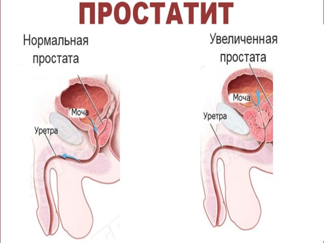 Сегодня поговорим, как довести девушку до оргазма через анал