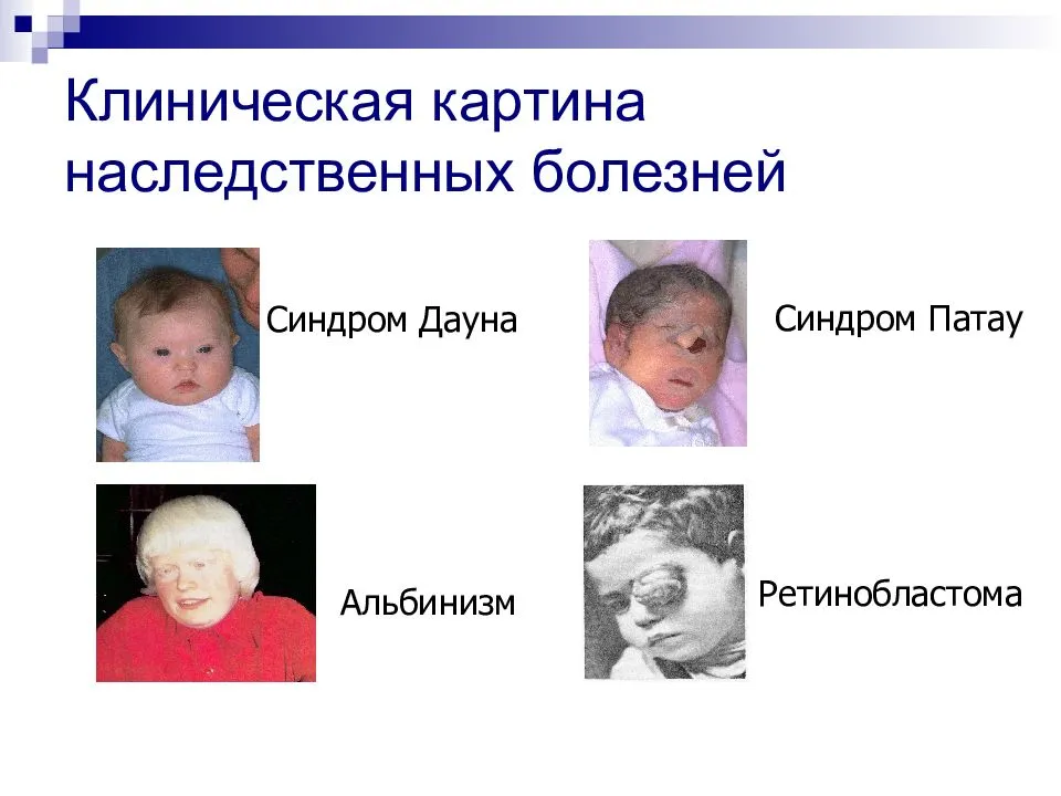 Чем болеют россияне? - женское здоровье