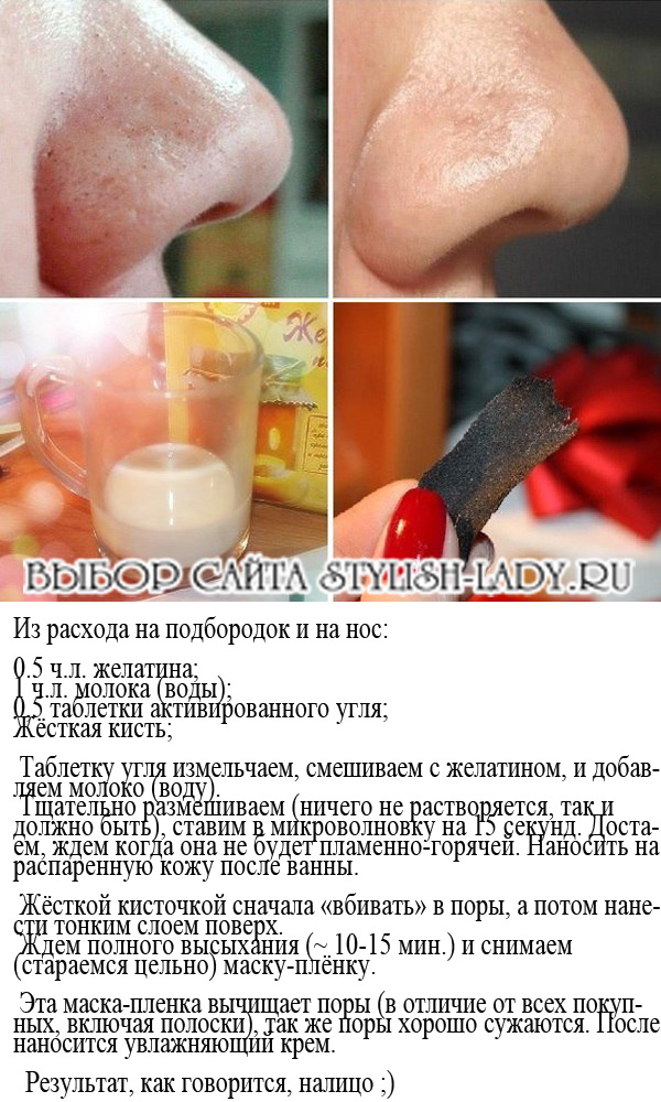 Как на лице убрать следы от прыщей – шаги к идеальной коже