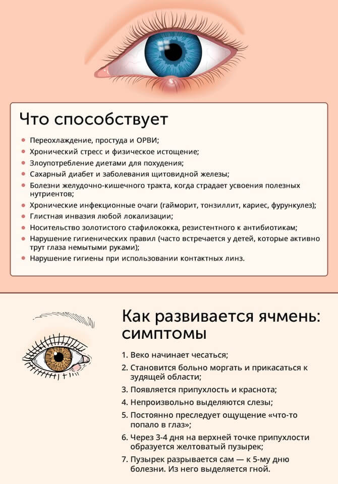 Ячмень на веке глаза: причины появления, лечение, вскрытие ячменя.