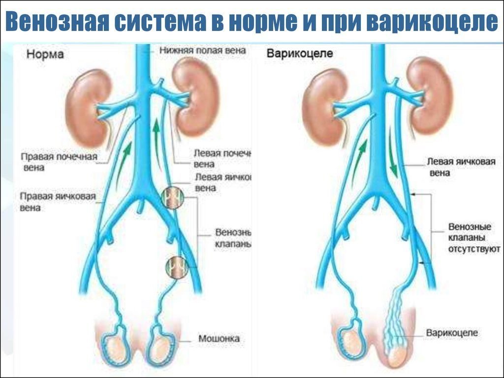 Какого размера должны быть яички у мужчин