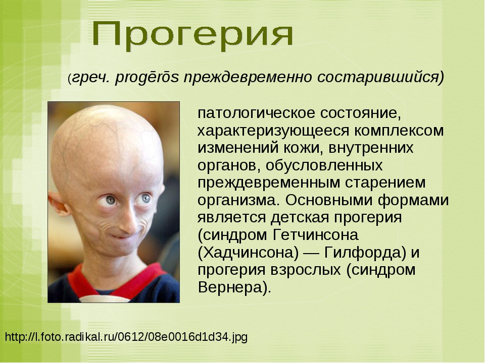 Знак неравенства: международное исследование объяснило связь между бедностью и распространением covid-19