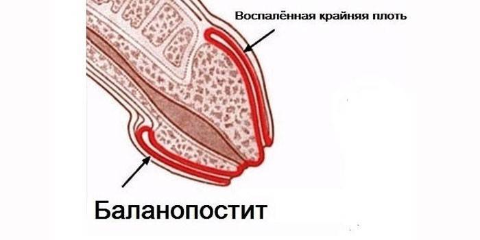 Почему пенис выглядит именно так, а у мужчин не бывает множественных оргазмов? — нож