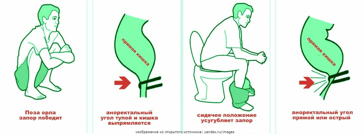Почему во время интимной близости мне хочется в туалет по маленькому...