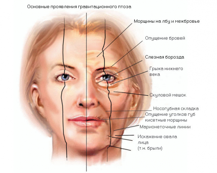 5 причин, почему мужчине стареющая женщина становится неприятной