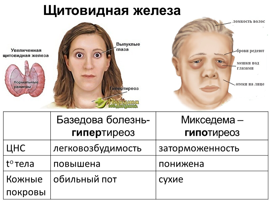 Какие дети рождаются от родственных связей. чем опасны близкородственные браки? последствия родственных союзов