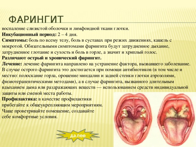 Тонзилитные пробки на миндалинах и гландах в горле (казеозные, гнойные): причины, лечение, удаление