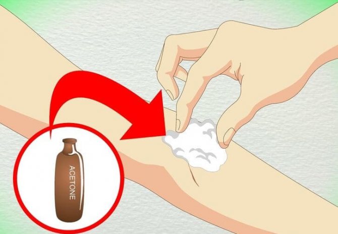 Как отклеить лейкопластырь от кожи безболезненно