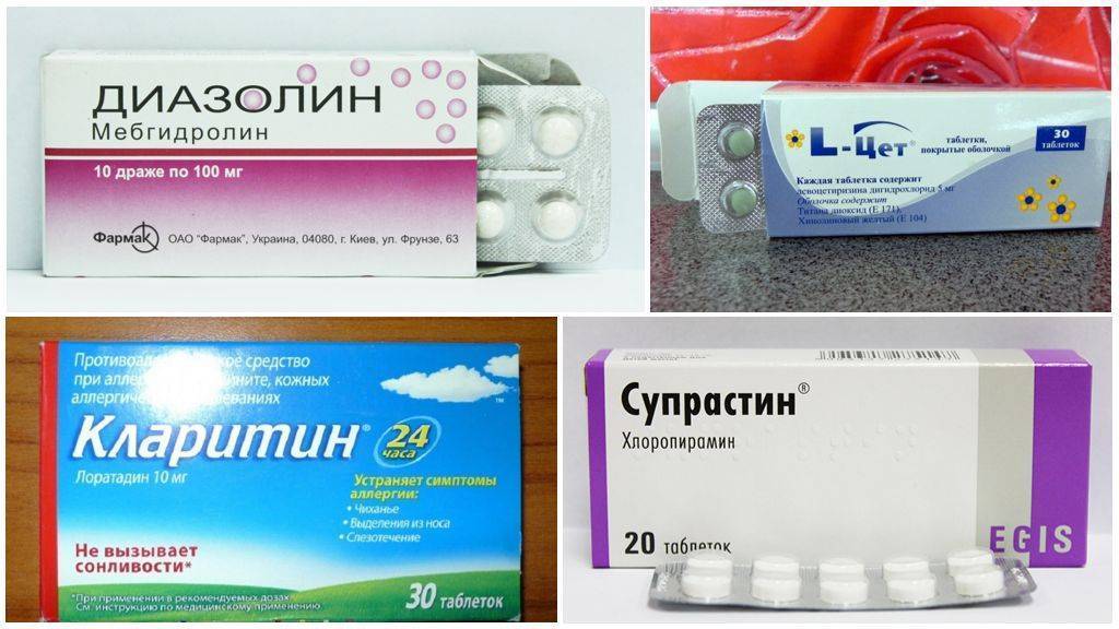 Аллергия на кошек: правила совместной жизни