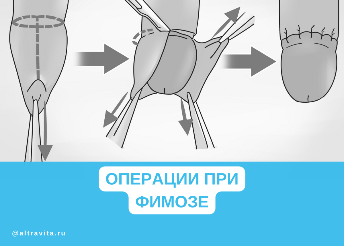 8 вещей, которые вы не знали о своем пенисе
